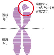 染色体の異常(欠失)の表